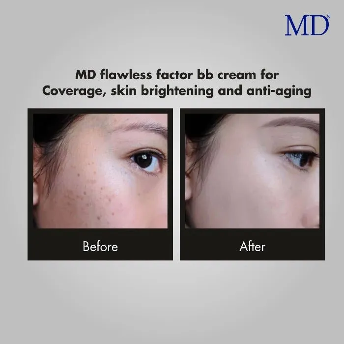 MD® Flawless Factor BB Cream- Anti-Aging & Skin Brightening| MD®- 1.76 Fl Oz